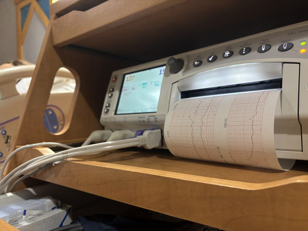 heartrate unborn baby ekg paper and monitor in maternity ward